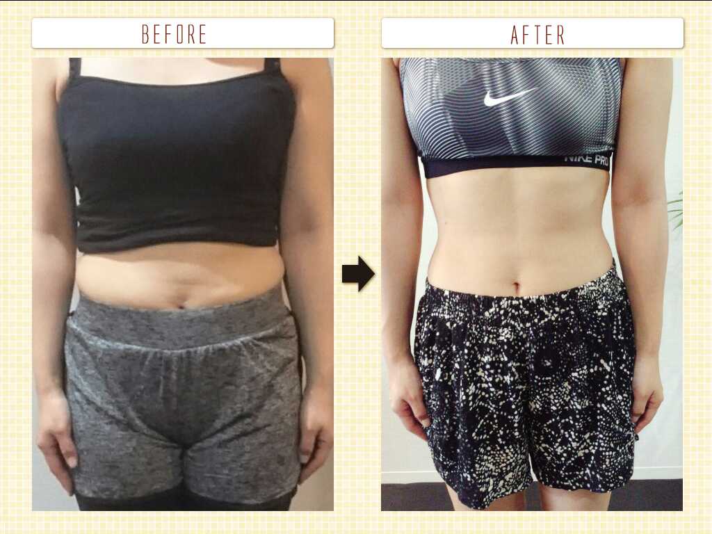 Before After