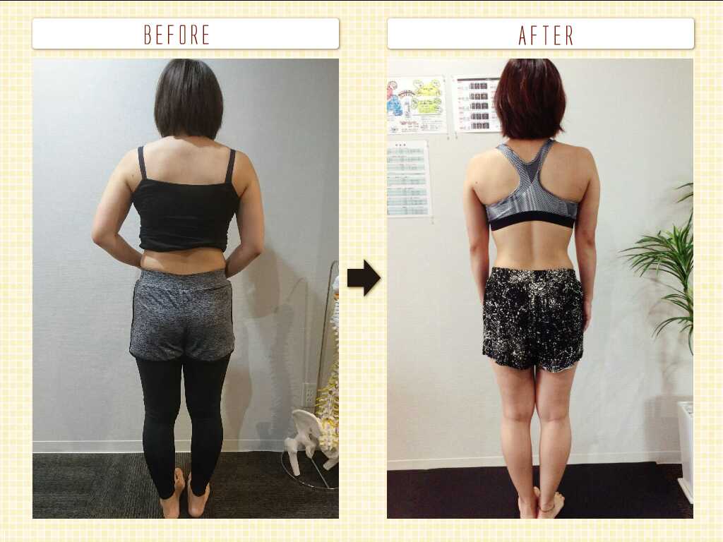 Before After